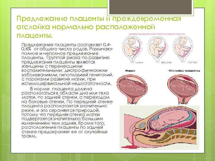 Полное предлежание хориона. Центральное предлежание плаценты на УЗИ. Расположение плаценты на передней стенке матки. Норма прикрепления плаценты.