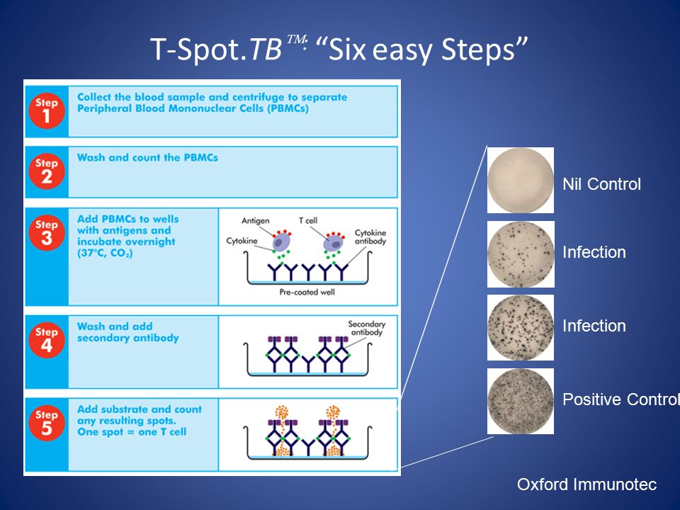 Режим спот. T-spot.TB тест. Т спот. T spot интерпретация результатов. T spot тест на туберкулез.