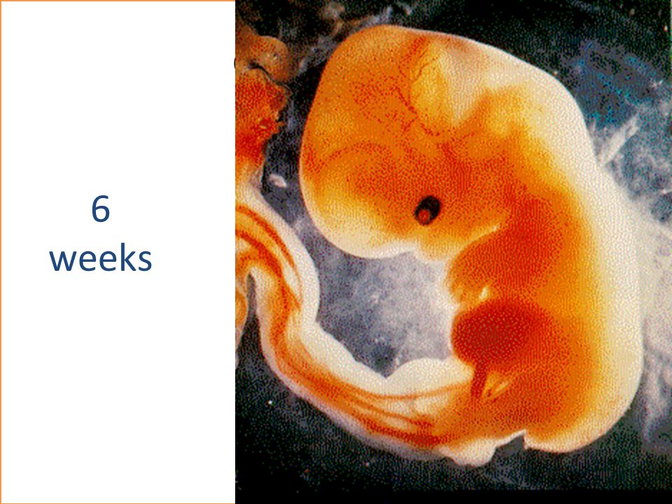Шесть недель беременности фото