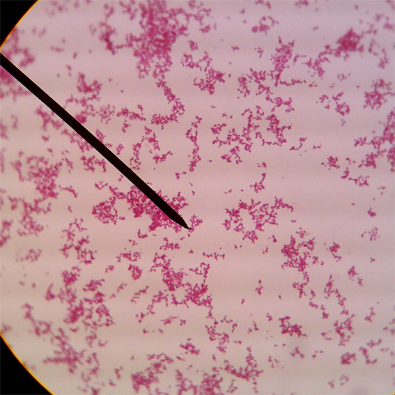 Микропрепарат бактерий. 5. Грамположительные палочки. Энтеробактерии.. Грамотрицательные кокки под микроскопом. Pseudomonas aeruginosa микроскопия. Кокки мазок микроскопия.