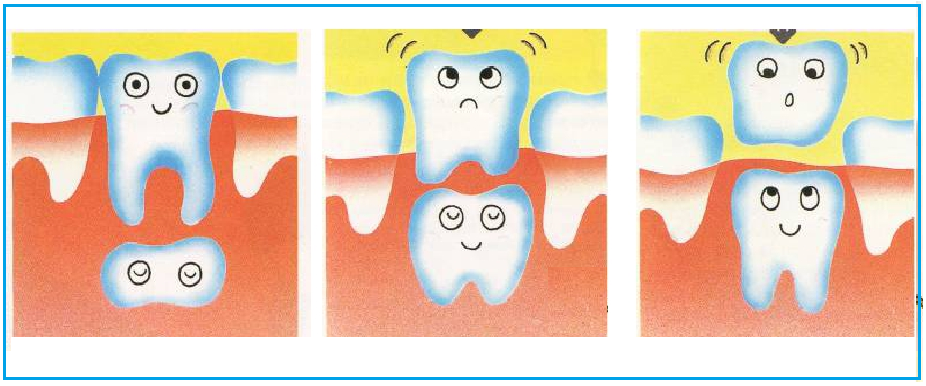 Как отличить молочный зуб. Молочные и коренные зубы у детей. Строение молочного зуба у детей.