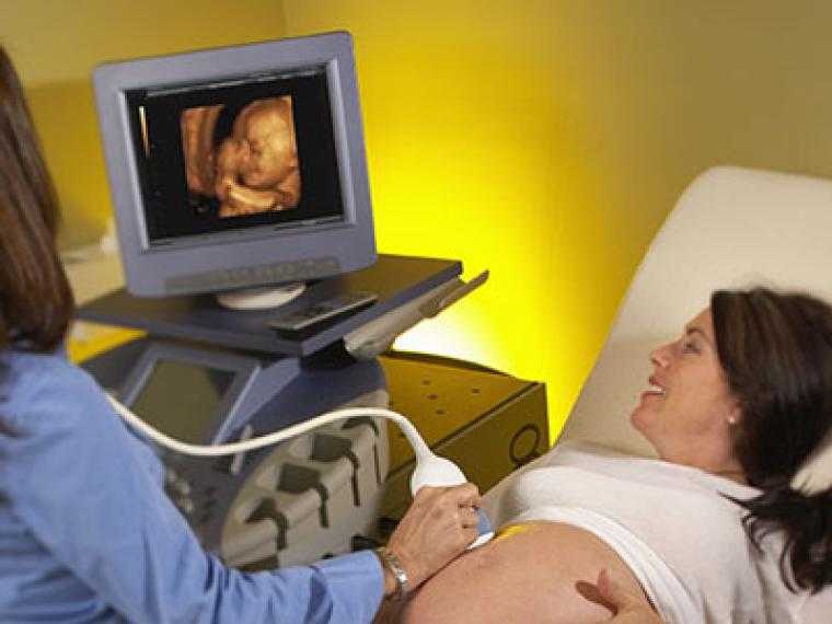 Допплерография ребенку. УЗИ третий триместр беременности доплер. УЗИ допплер. УЗИ допплерометрия плода. УЗИ плода с допплерография.