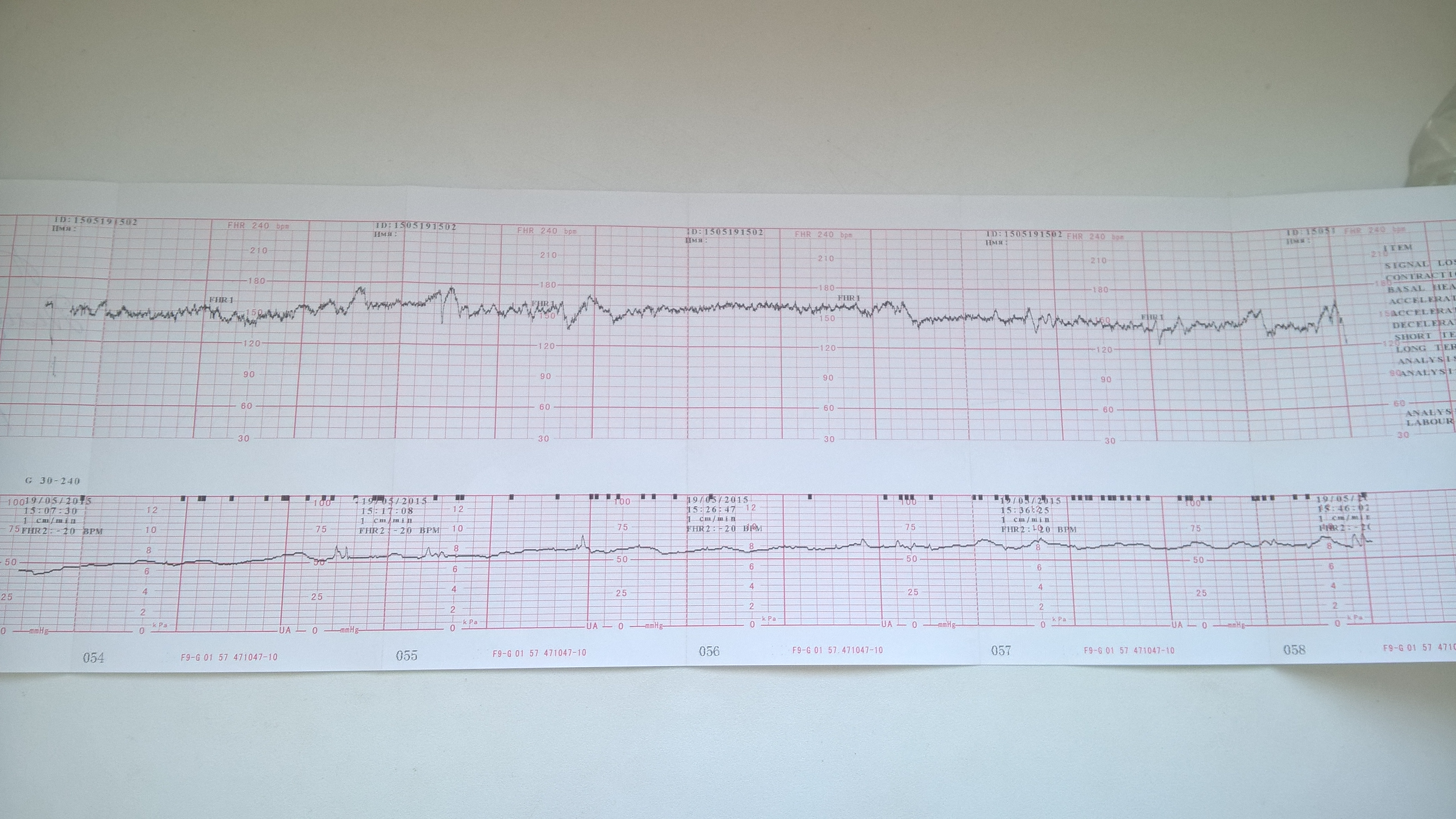 Фото ктг беременной