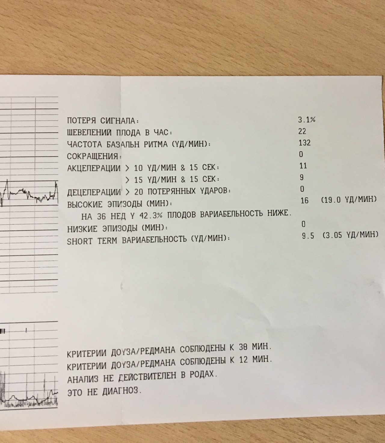 Ктг расшифровка. Норма вариабельности в КТГ В 32 недели. Критерии Доуза Редмана КТГ. КТГ при беременности норма 36 недель. Показатели КТГ норма.