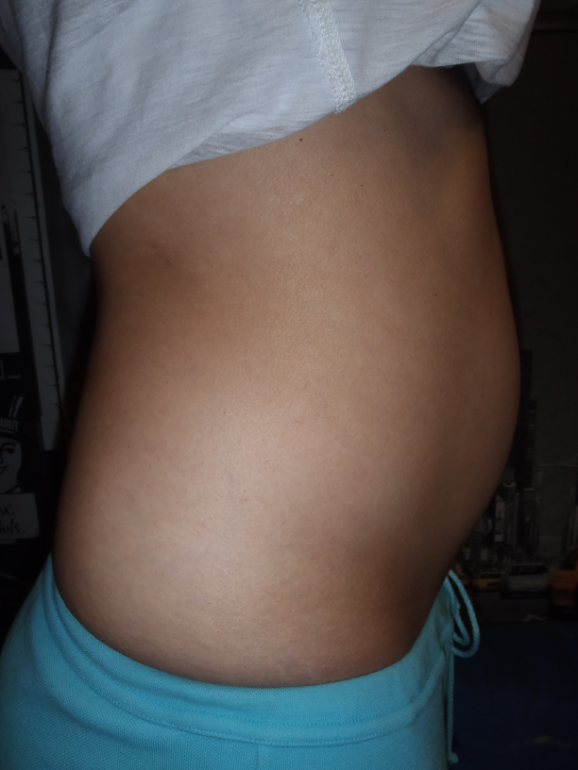 Беременность на 4 месяце фото живота