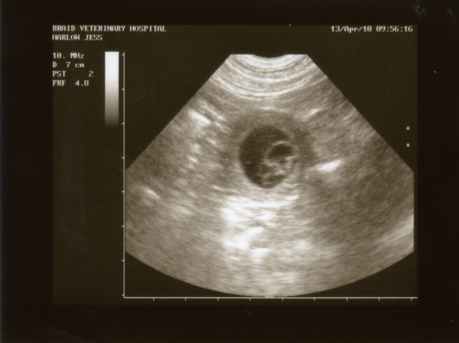 Как выглядит плод в 4 5 недель беременности фото