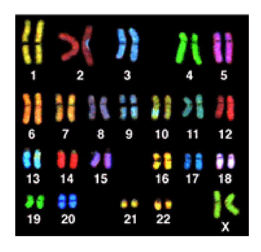 Кариограмма это. Кариограмма хромосом. Кариограмма хромосом женщины. Спектральный кариотип. Нормальный кариотип человека окрашенный.