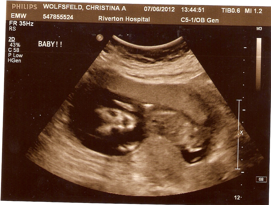 8 9 недель беременности что происходит с малышом и мамой фото