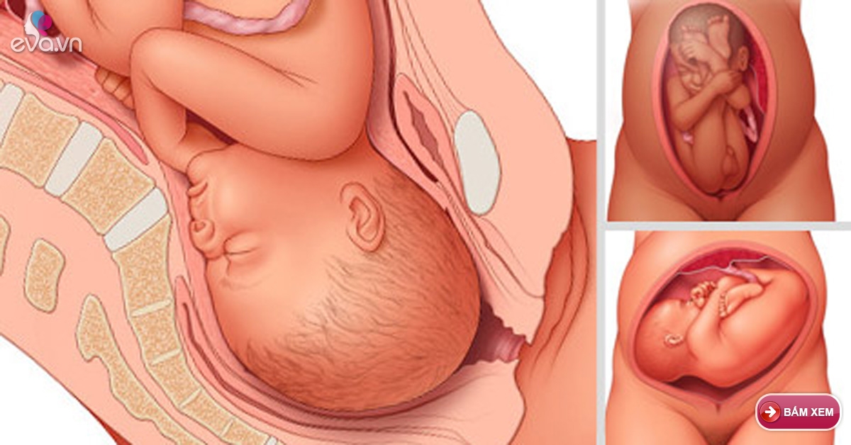 38 недель головка. Ребёнок 30 неделя беременности в утробе. Плод при беременности 30 недель. Расположение ребенка в животе. Расположение ребенка в животике.