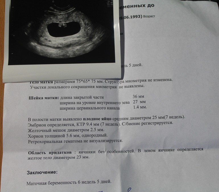 9 мм беременность