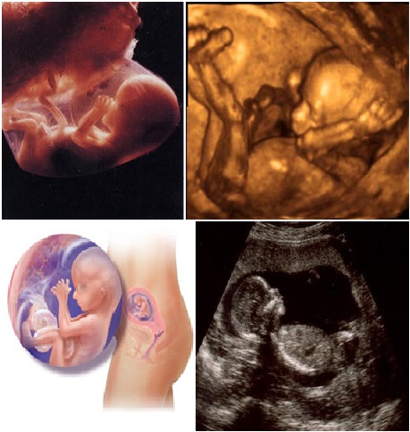 Шестнадцати недель. 16 Недель беременности размер плода фото. Эмбрион на 16 неделе беременности. Эмбрион на 17 неделе беременности.