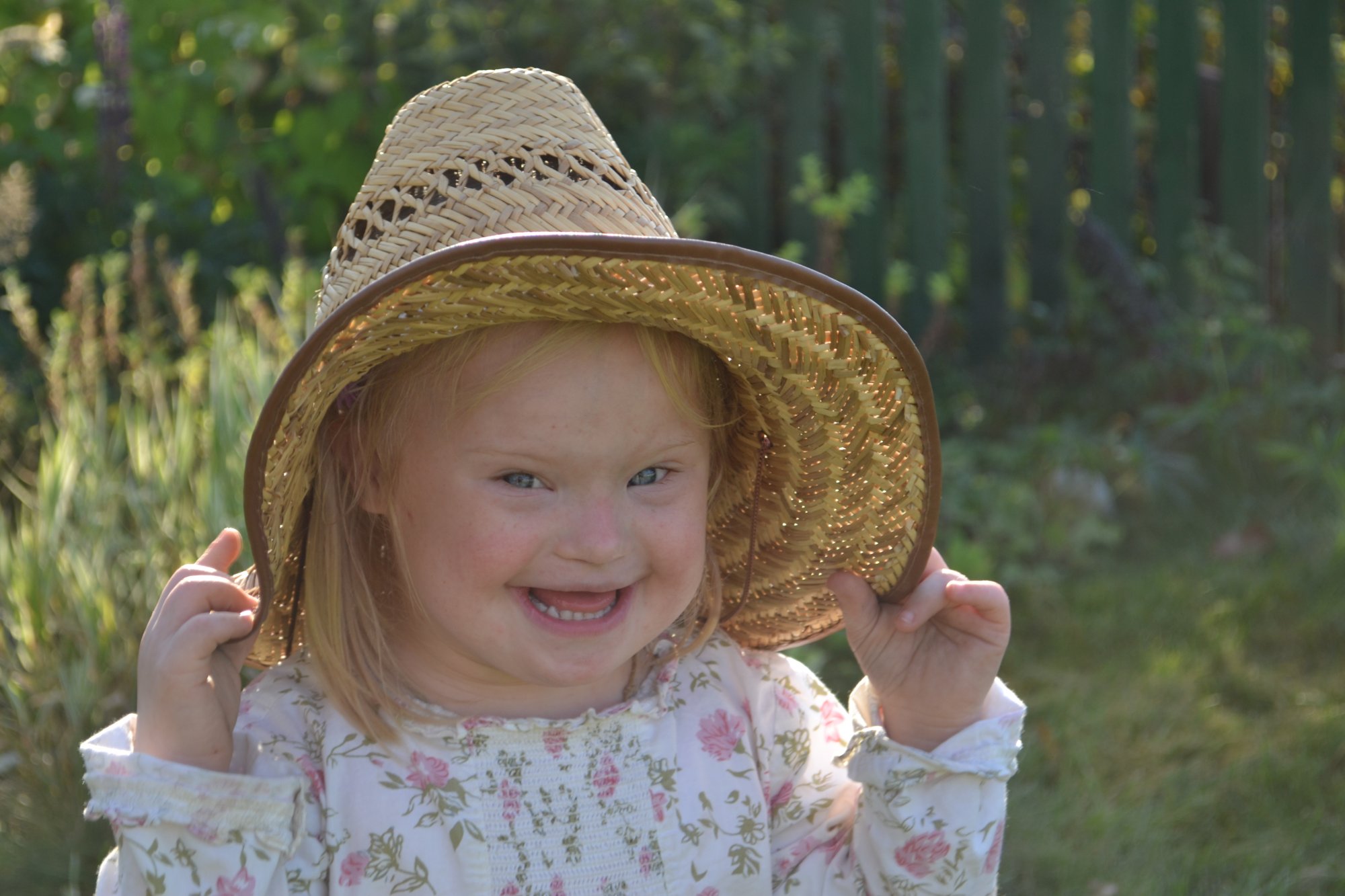 Фото солнечных детей с синдромом дауна
