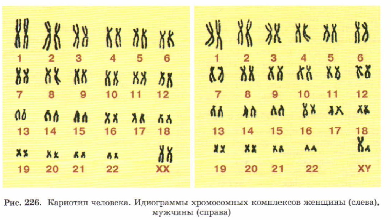 Кариотипы мужские и женские. Нормальный кариотип человека 46 хромосом. Идиограмма кариотипа человека. Хромосомная карта кариотип. Нормальный кариотип человека рисунок.