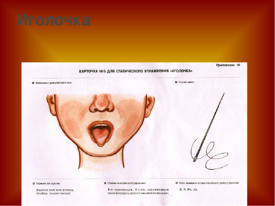 Артикуляционная гимнастика иголочка в картинках