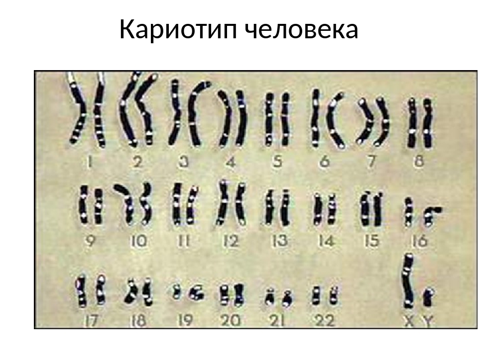 Хромосомный набор клеток мужчин. Нормальный кариотип человека 46 хромосом. Хромосомы кариотип. Нормальный кариотип человека рисунок. Кариотип здорового человека.