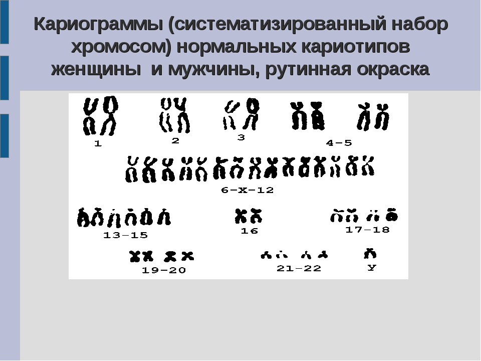 45 хромосом. Систематизированный кариотип это. Кариограмма хромосом. Нормальный хромосомный набор женщины. Кариограмма мужчины.