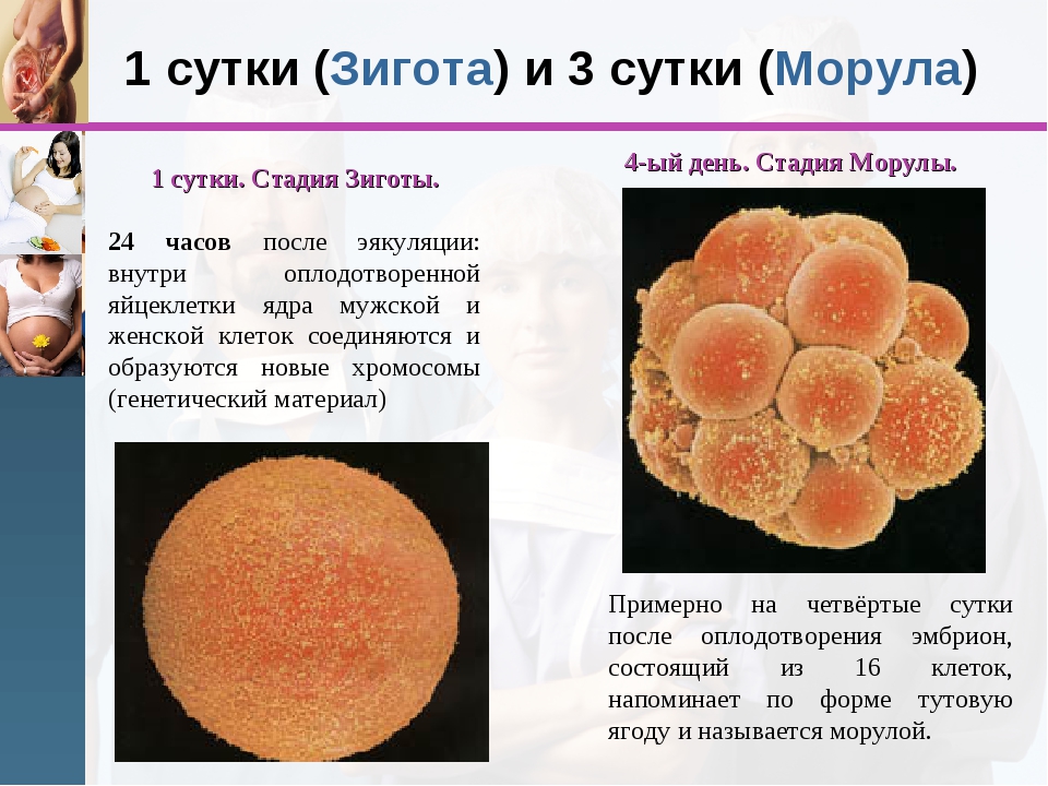 Стадии развития зародыша морула. Зигота морула. Морула это в эмбриологии. Морула это зародыш на стадии. Яичник зигота