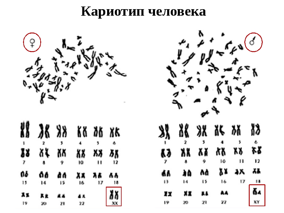 Набор хромосом 5. Кариотип это в биологии. Кариотип здорового человека формула. Хромосомная карта кариотип. Хромосомы кариотип.