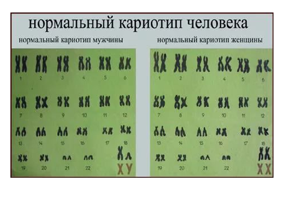 Хромосомный набор человека картинка