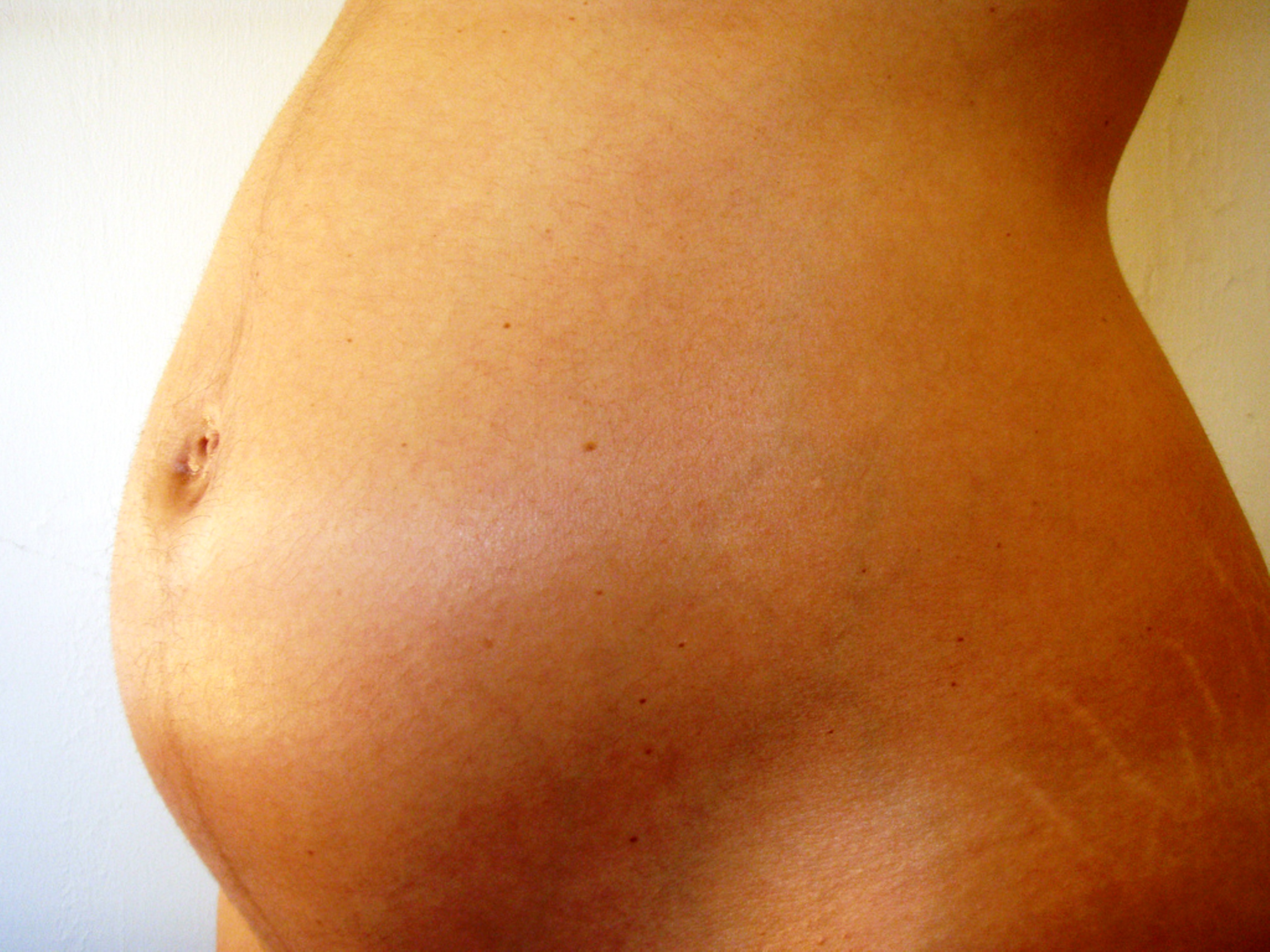 чешутся растяжки на груди при беременности фото 108
