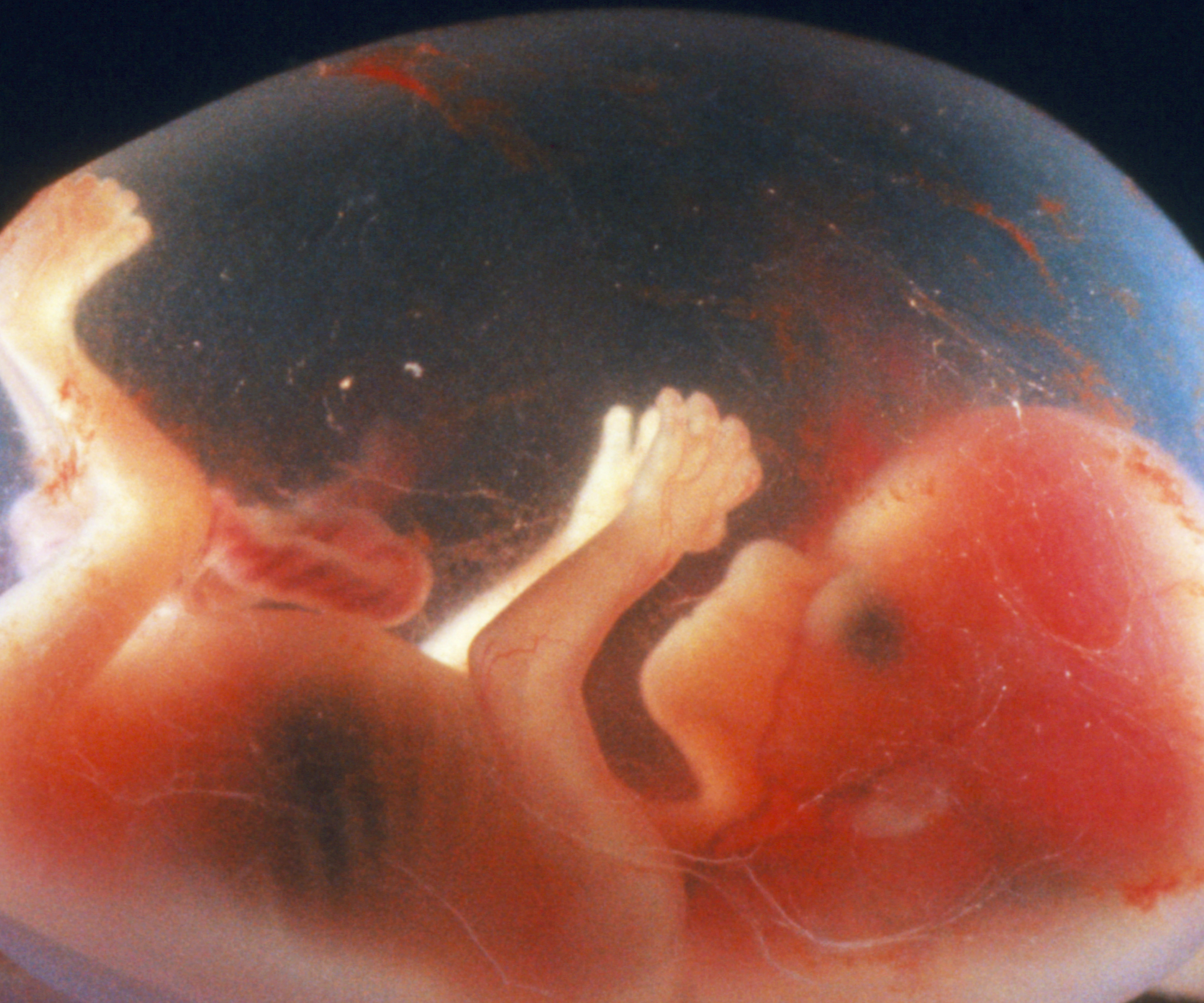 14 недель б. Эмбрион на 14 неделе беременности. 14 Недель беременности фото плода. Плод ребенка на 14 неделе беременности фото. Эмбрион на 13 неделе беременности.
