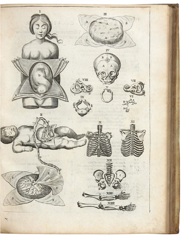 Род в медицине. Анатомические зарисовки Леонардо да Винчи. Старинные медицинские Гравюры. Старинные медицинские рисунки. Анатомия старые рисунки.