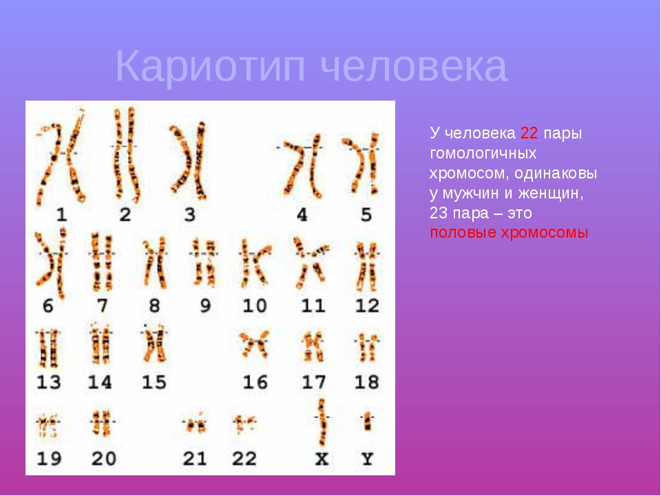 Кариотип человека определяют. Нормальный кариотип человека 46 хромосом. Кариотипирование хромосом. 46 ХХ нормальный женский кариотип. Кариотип половых клеток.