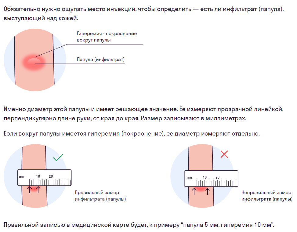 Проба диаскинтест что. Диаскинтест на туберкулез.