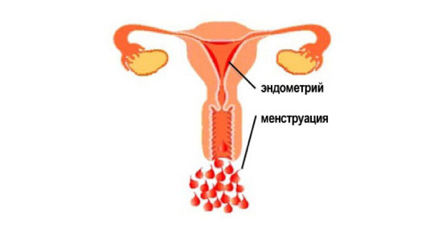 Почему у девочек месяльные. Нерегулярные менструации.