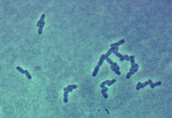 Эшерихии в мазке. Escherichia coli под микроскопом 1000x. Escherichia coli m17 микроскоп. Эшерихия коли в Кале микроскопия. Эшерихии увеличение 1000 раз.