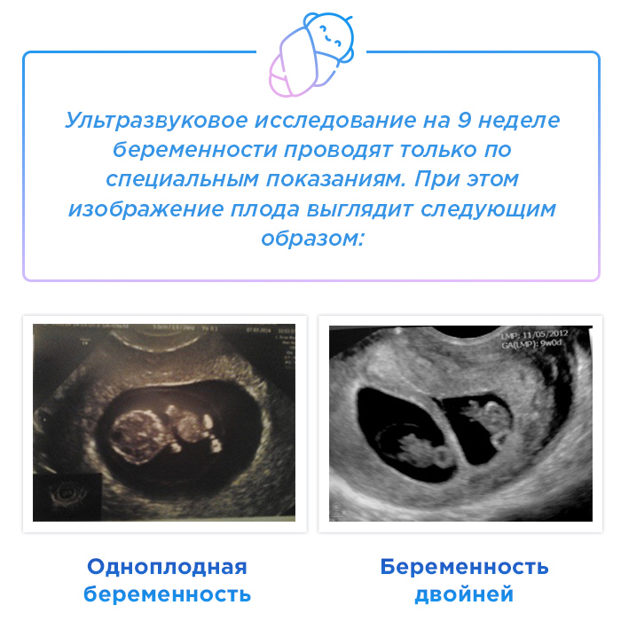 Развитие эмбриона по неделям беременности фото узи