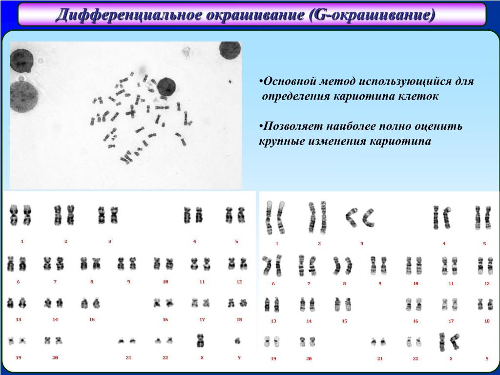 Парижская хромосома. Кариотип половых клеток. Метод определения кариотипа. Современные методы изучения кариотипа человека. Заболевания изучения кариотипа.