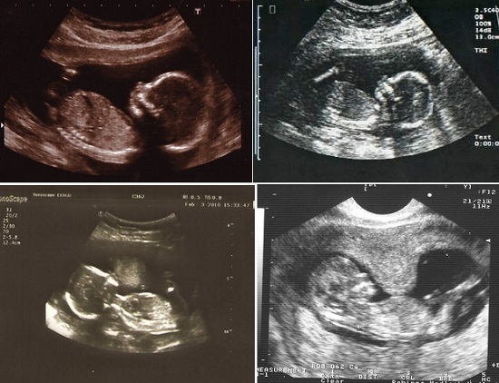 Конец 17 недели. 17ая неделя беременности. 17 Недель беременности фото ребенка. 16 Акушерская неделя беременности.