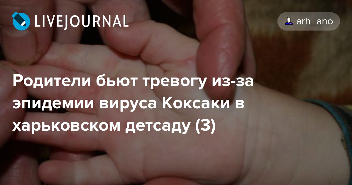 Как выглядит сыпь при коксаки фото
