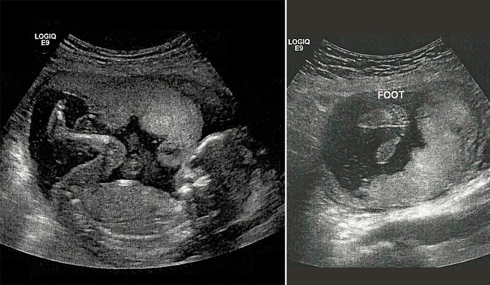 Ребенок в 16 недель беременности фото размер плода
