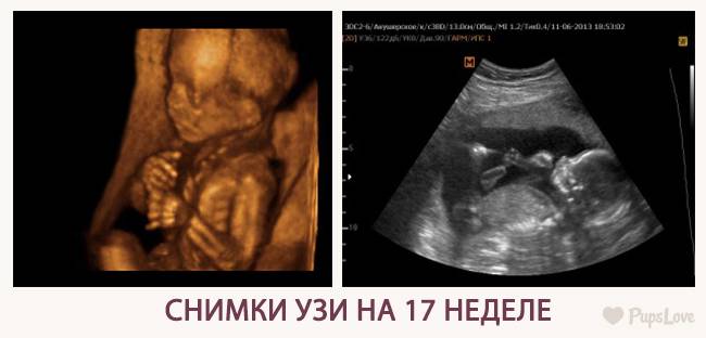 Сегодня 17 недель. Плод в 17 недель беременности УЗИ плода. Малыш на 17 неделе беременности УЗИ. Снимок УЗИ на 17 неделе беременности. Малыш на 18 неделе беременности УЗИ.