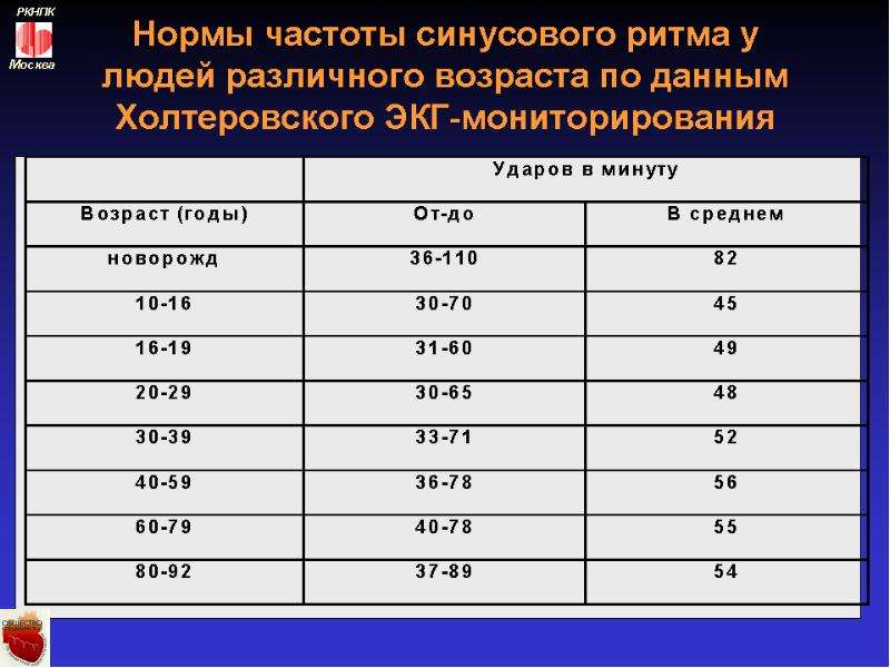 Нормальные частоты. ЭКГ норма показатели ЧСС. Холтер ЭКГ показатели. ЧСС на ЭКГ норма. Расшифровка суточного мониторинга ЭКГ таблица норма.