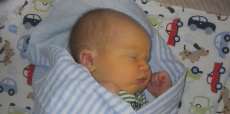 Увеличена печень у новорожденного. Желтушка у новорожденных фото. Слабая желтушка новорожденного. Высокий билирубин у ребенка.