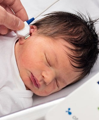 Регистрация отоакустической эмиссии. Отоакустическая эмиссия у новорожденных. Аутоскрининг новорожденных. Аудиоскрининг новорожденных аппарат. Аудиологический скрининг.