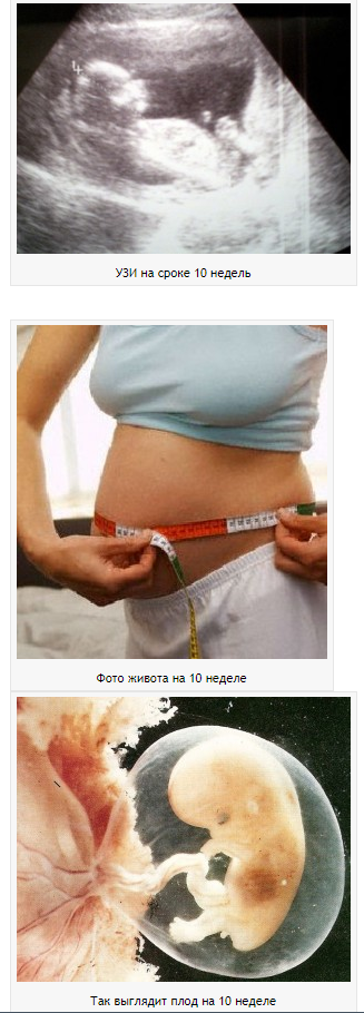 УЗИ 10 недель беременности. Симптомы 10 недели