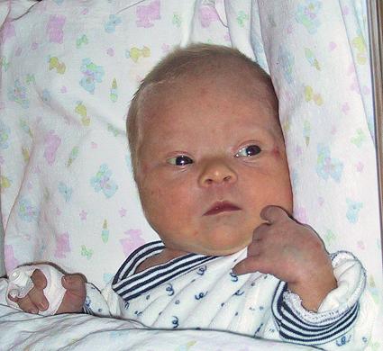 Как выглядит новорожденный ребенок с синдромом дауна фото