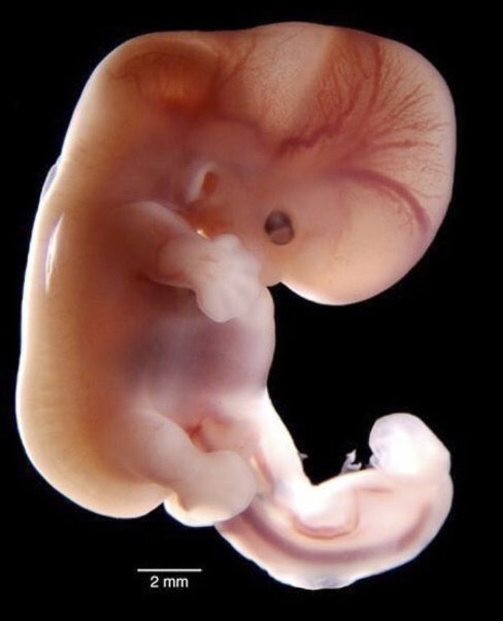 Пятая неделя ребенку. Эмбрион на 9 неделе беременности. Эмбрион на 8 неделе беременности. Зародыш на 8 неделе беременности. Эмбрион на 9 неделе беременности фото.