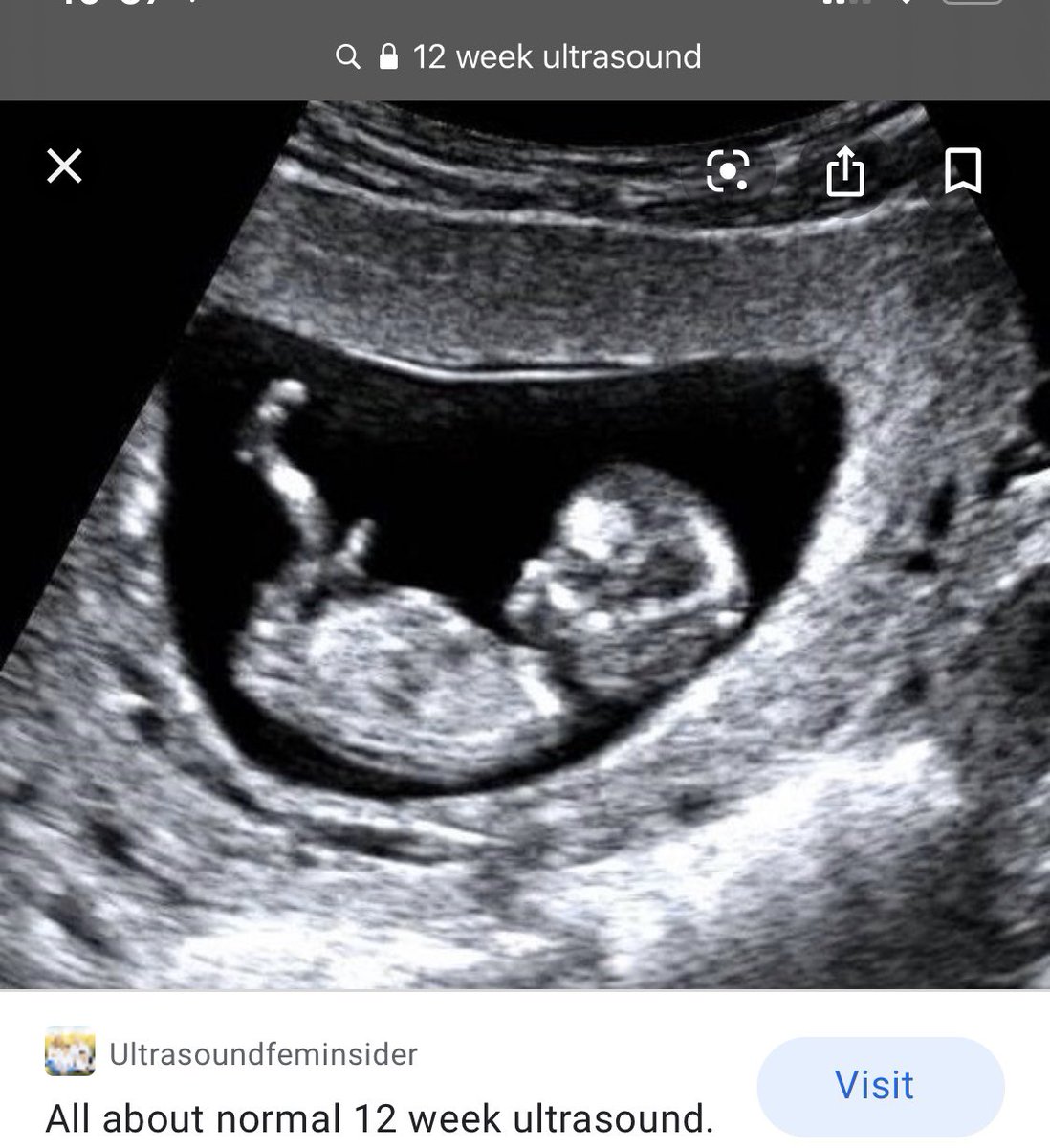 Фото ребенка 13 недель. УЗИ 12-13 недель беременности. УЗИ 12 недель беременности. УЗИ 3 месяца беременности мальчик. УЗИ 13 недель беременности.