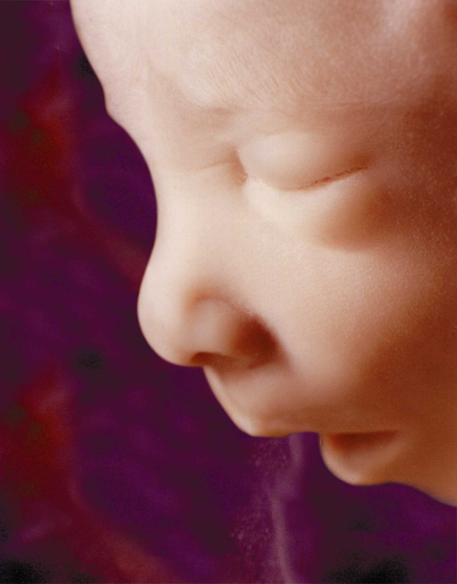 Эмбрион на 17 неделе беременности