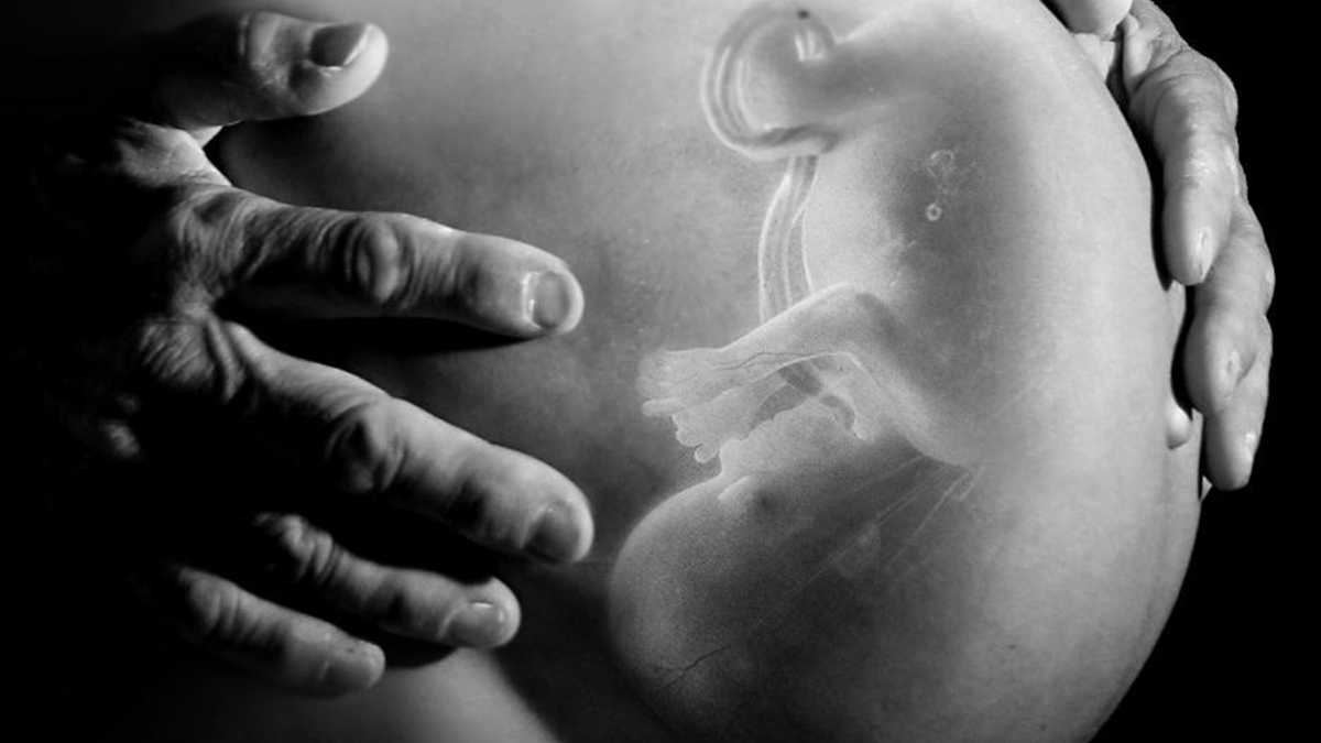 Рентген ребенка в утробе матери