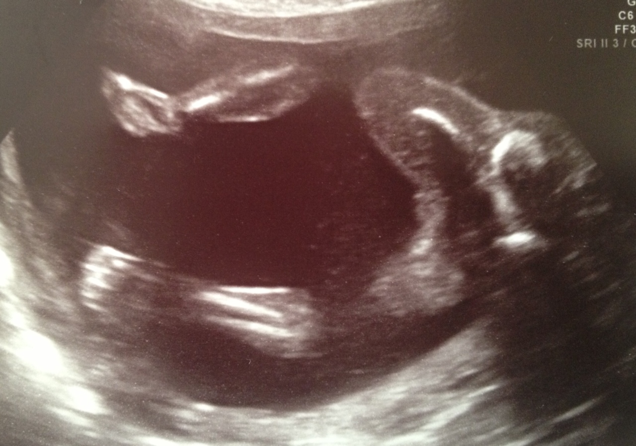 19 недель воды. 19 Недель беременности фото. 18 19 Недель беременности. Беременность 18-19 недель фото.