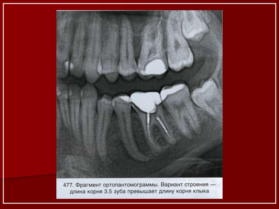 Какие корни у зубов на нижней челюсти человека фото