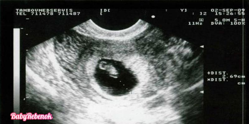 Акушерские недели признаки. Снимок УЗИ на 4 неделе беременности. УЗИ беременности по неделям 4 недели. УЗИ 4 недель беременности УЗИ. УЗИ беременной на 4 акушерской неделе.