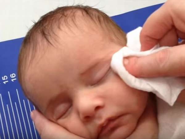 Новорожденным можно промывать. Глаза новорожденного. Промывание глаз новорожденному. Обработка глаз новорожденного. Протирание глаз новорожденного.