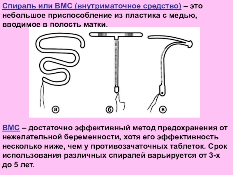 После введения вмс. Спираль ВМС. Спираль внутриматочная. Спираль от беременности. Спираль внутриматочная СССР.